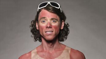 Sonnenschutz für Radfahrer I Portait Mann mit Sonnenbrand